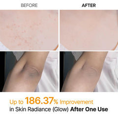 Dr.Melaxin Peel Shot | Exfoliating Kojic Acid | Turmeric Spray 200ml