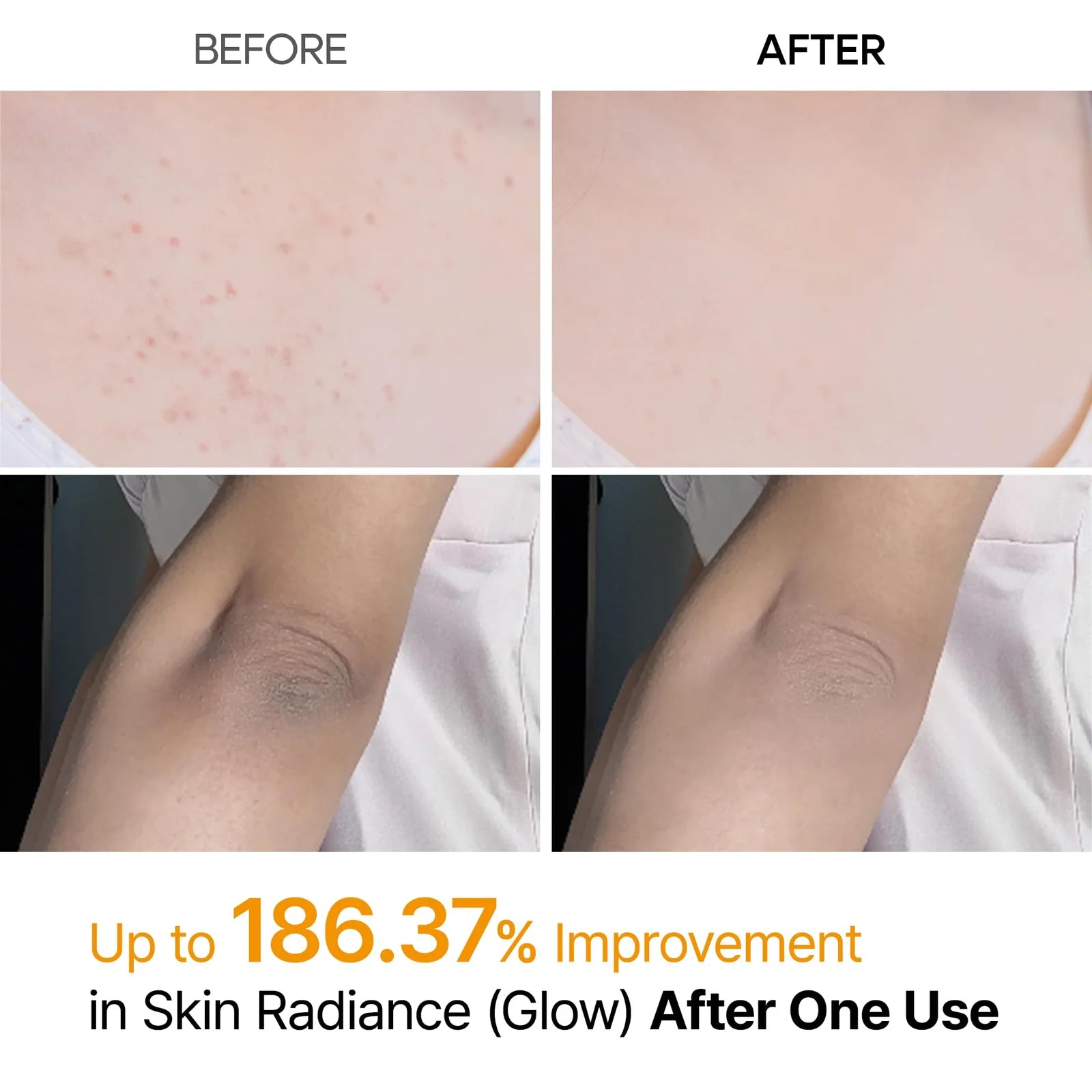 Dr.Melaxin Peel Shot | Exfoliating Kojic Acid | Turmeric Spray 200ml